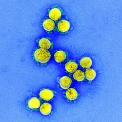 Mikroskopische Aufnahme, gelbe Viruszellen auf blauem Hintergrund.